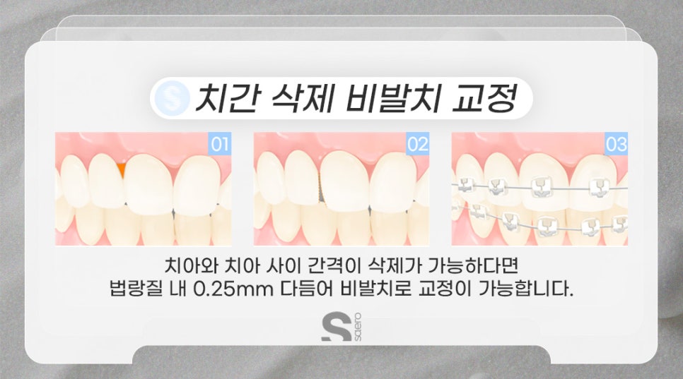 치아교정할 때 발치해야 하는 이유 (비발치중심 치아교정) 관련 이미지 5