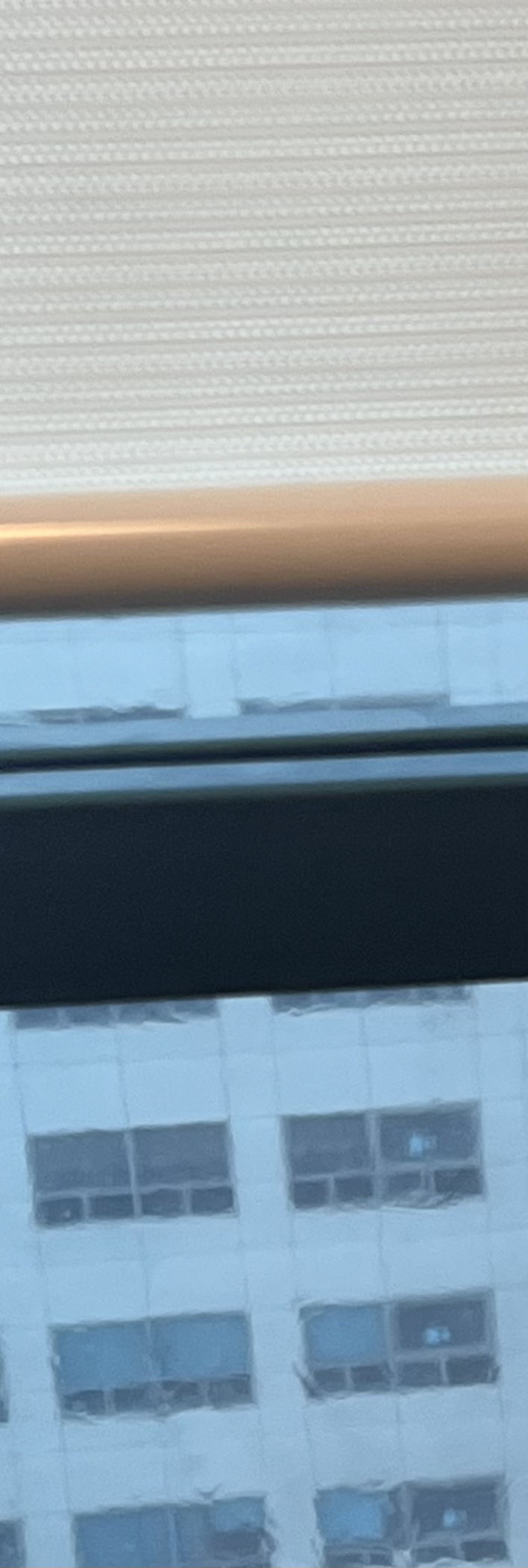 발치 후 교정, 이빨을 뽑지 않는 치료 방법이 있다? 관련 이미지 16