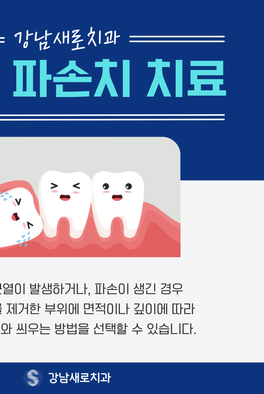 강남역 충치치료, 치아의 문제를 개선하는 과정? 관련 이미지 2