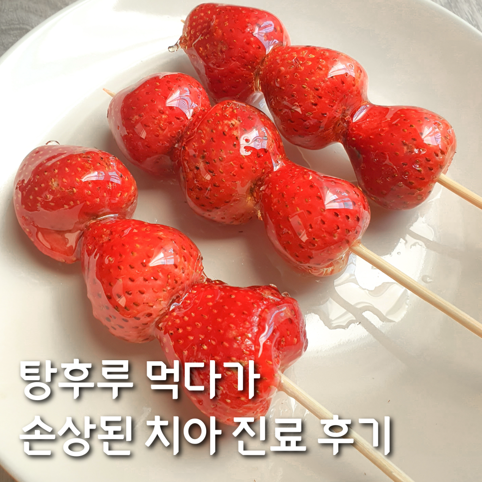 탕후루 치아 손상된 사례 진료 후기 관련 이미지 1