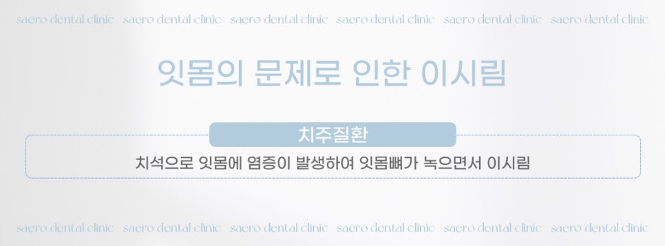 갑자기 이가 시리다면? (이시림원인 이시림해결) 관련 이미지 4