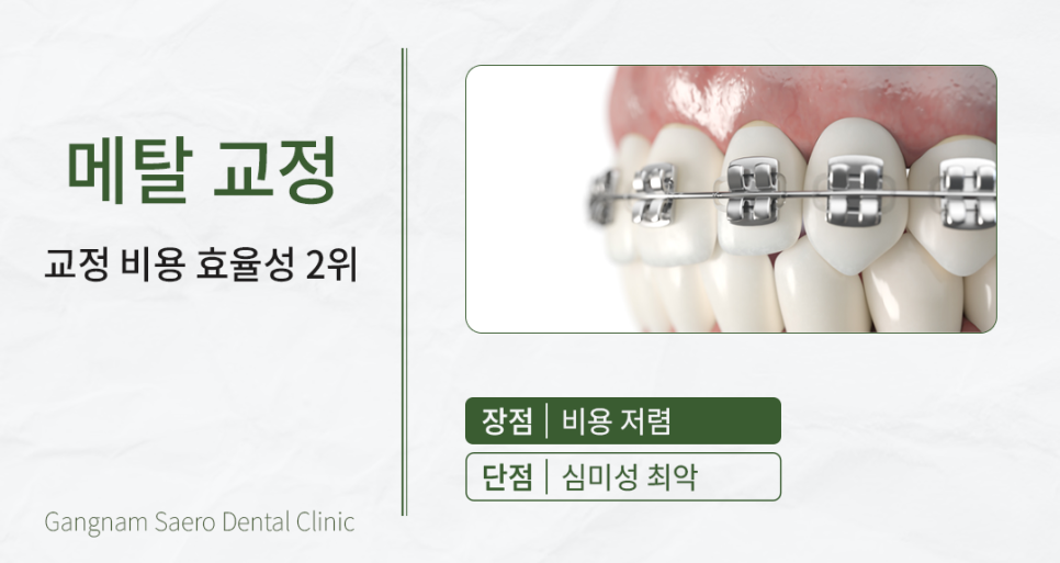A Time- and Money-Saving Approach to Orthodontic Treatment (Orthodontic Treatment Cost) image 3