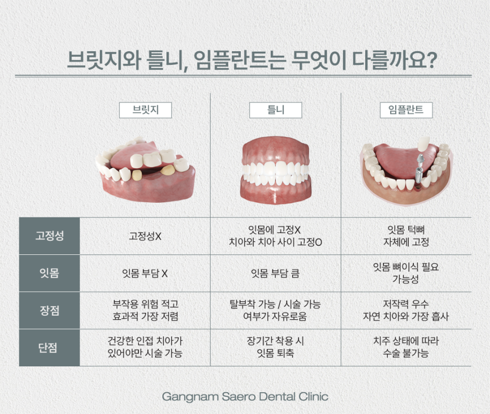 치아를 잃었을 때 치료 방법 (치과 브릿지) 관련 이미지 3