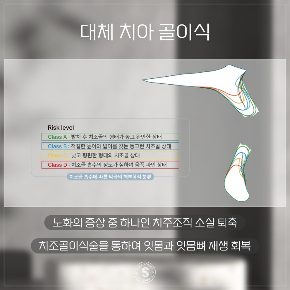 나이가 많은데 임플란트 가능할까요? (65세이상임플란트 건강보험적용) 관련 이미지 3