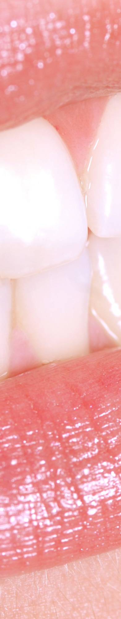 부정교합 교정치료, 비발치로 진행하려면? 관련 이미지 7