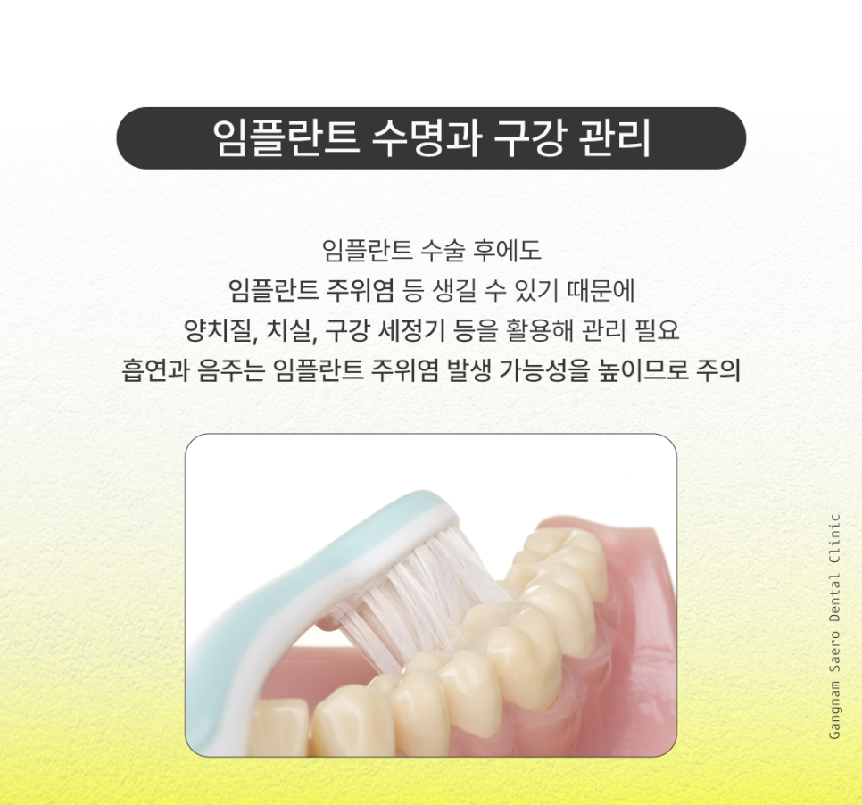 Implant Lifespan: Aren’t Implants Meant to Last a Lifetime? How to Use Them Longer image 2