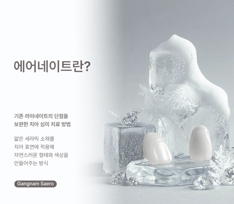 치아 삭제 부담을 줄인 심미 치료 (라미네이트대체 에어네이트) 관련 이미지 4