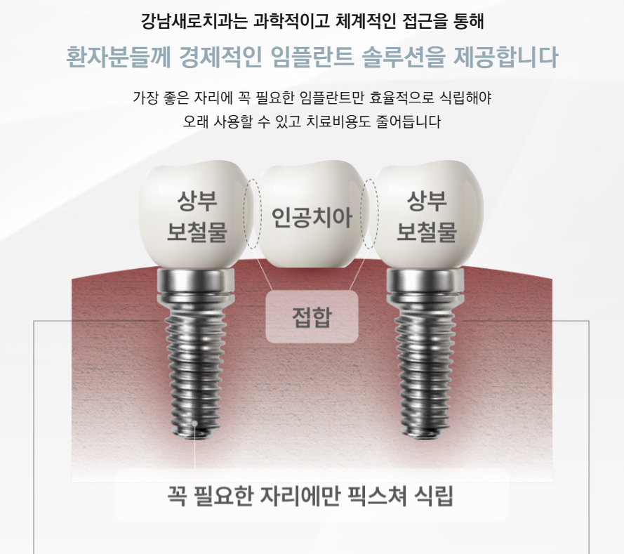 전체를 보면 하나의 결과가 보인다, 강남새로치과 전체임플란트 관련 이미지 3
