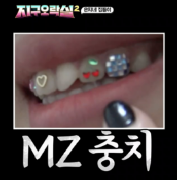 이영지투스젬, 리사투스젬 뜻? 시술 과정과 부작용 관련 이미지 8