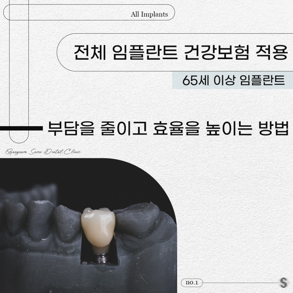 전체 임플란트 건강보험 적용 (65세이상임플란트) 관련 이미지 1
