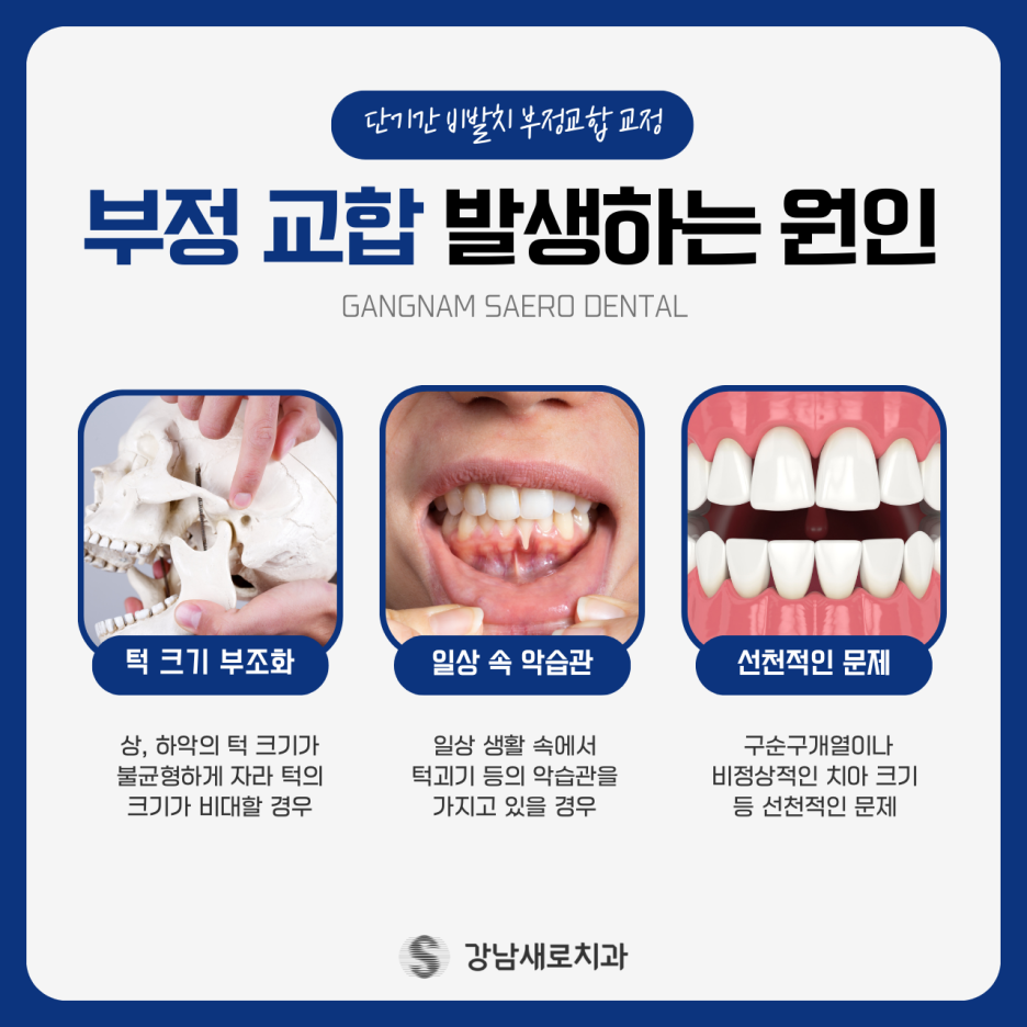 치아교정부작용. 종류와 예방 방법, 교정은 치료 잘 하는 곳에서! 관련 이미지 1