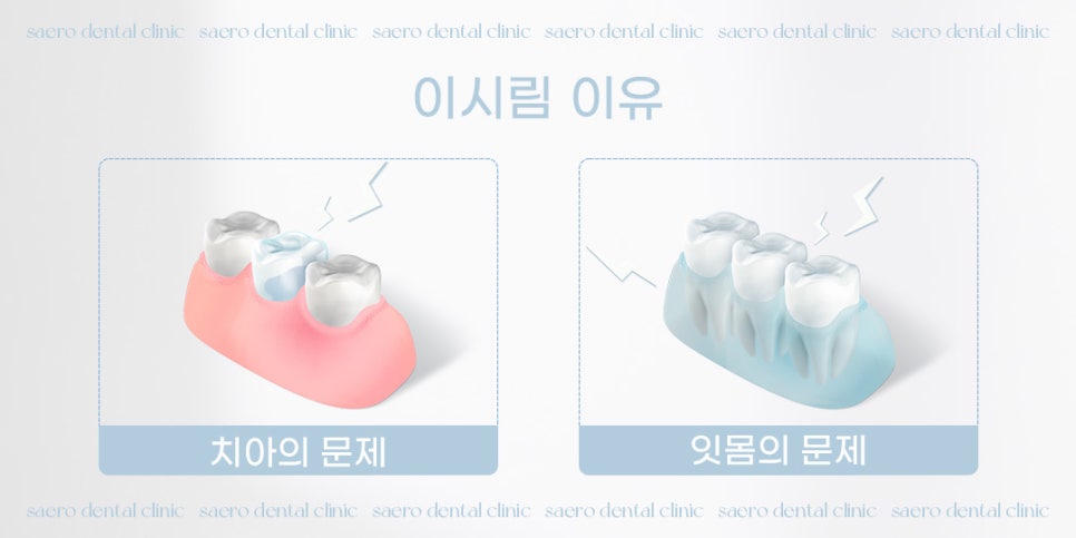 갑자기 이가 시리다면? (이시림원인 이시림해결) 관련 이미지 2