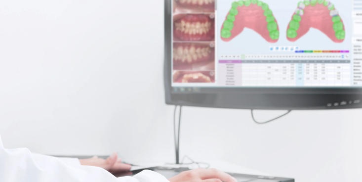 투명교정장치 다시 알아보기 (3) 매직얼라인 관련 이미지 3