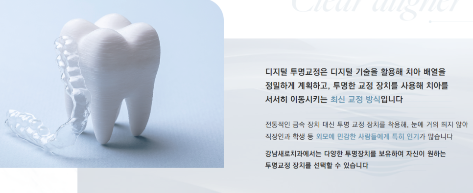치아교정종류 한눈에 보기 티 안나게 예뻐지고 싶다면 (투명교정) 관련 이미지 4