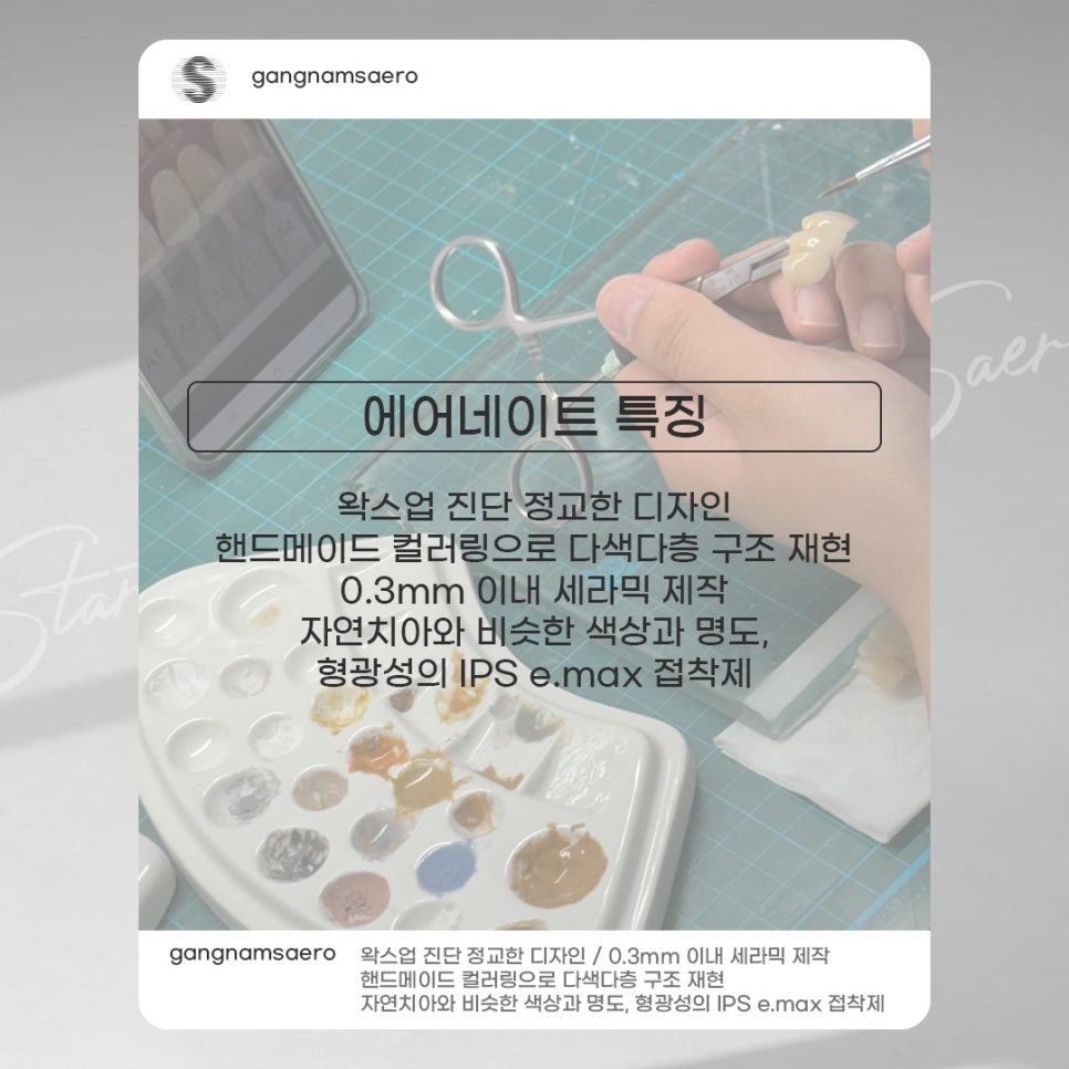 무삭제라미네이트 로 완성하는 가장 빠른 치아성형 (7DAYS치아성형) 관련 이미지 6