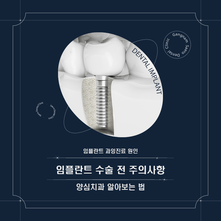 임플란트 과잉진료 원인과 양심치과 알아보는 법 (임플란트수술 전 주의사항) 관련 이미지 1