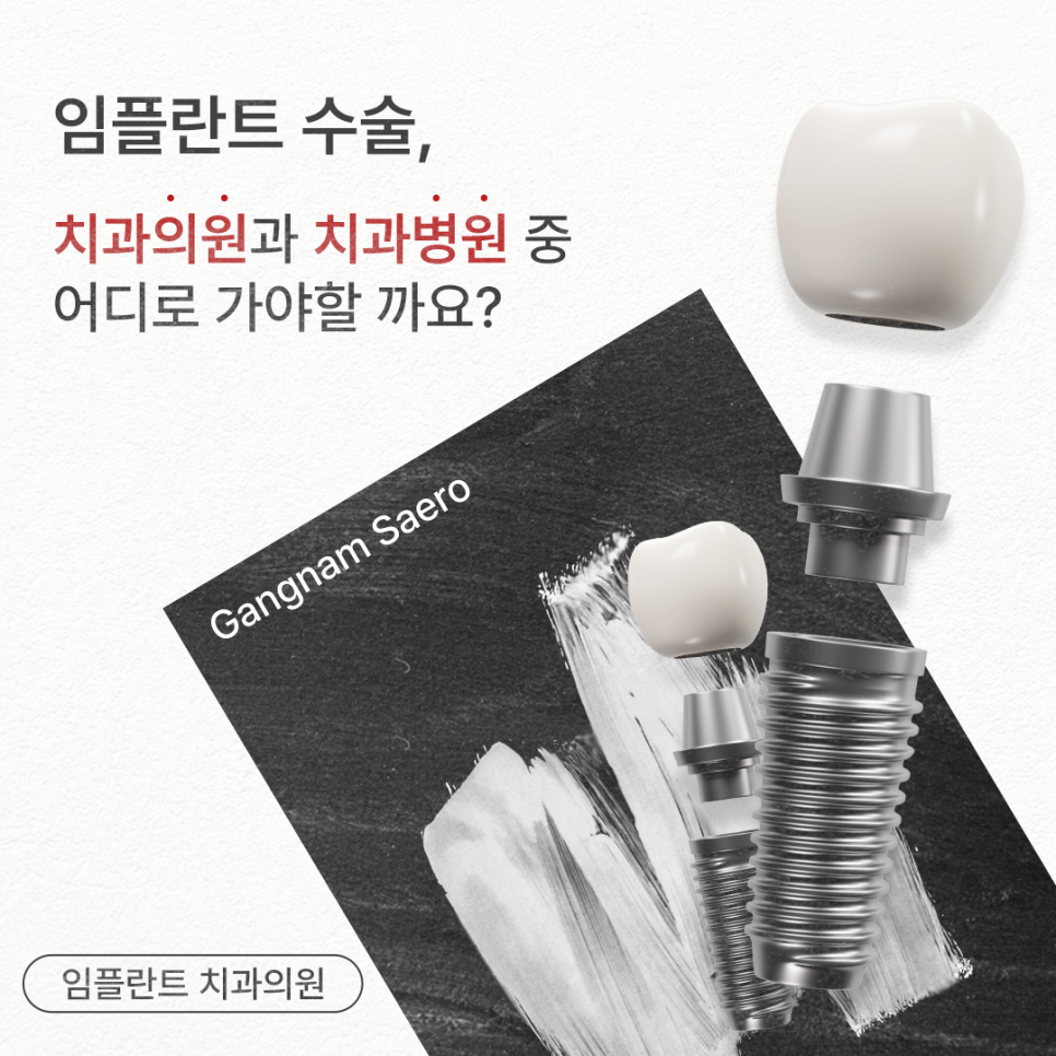 임플란트수술 치과의원 치과병원 중 어디로 가야할까요? (임플란트 치과의원) 관련 이미지 1