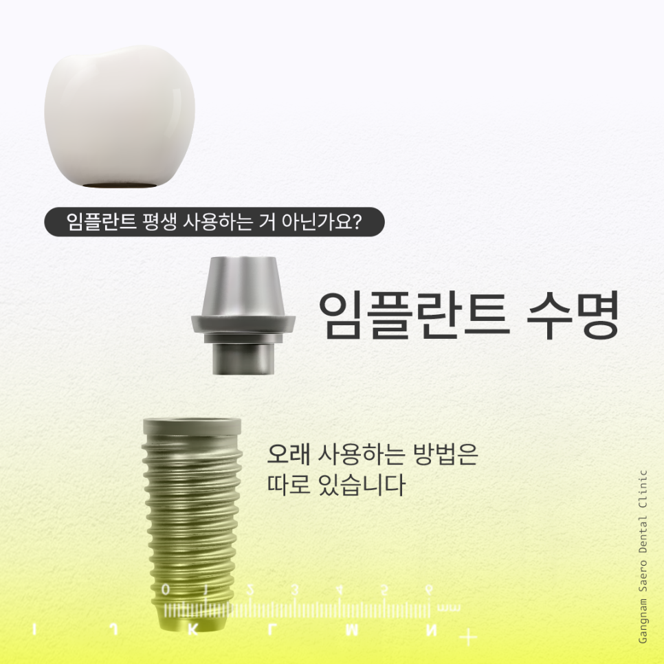 Implant Lifespan: Aren’t Implants Meant to Last a Lifetime? How to Use Them Longer image 1