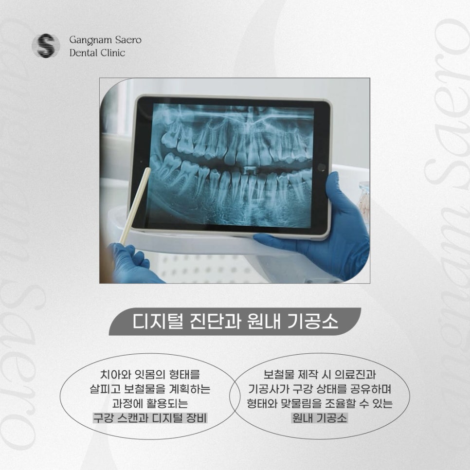 강남새로치과, 역 도보 5분 근처치과 임플란트부터 교정 라미네이트 관련 이미지 5