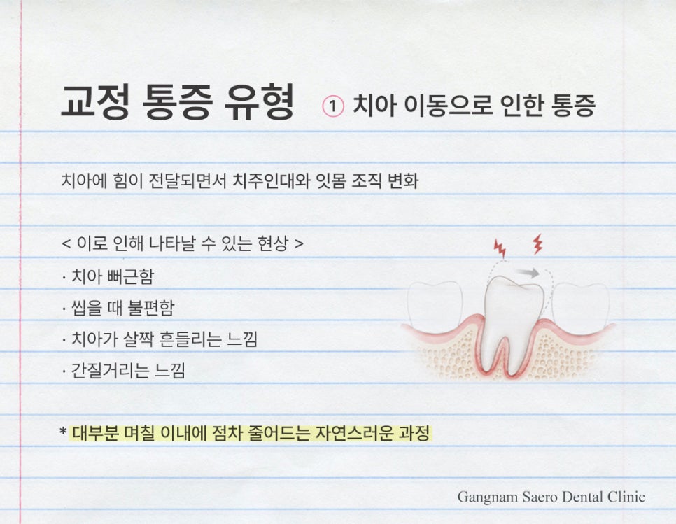 치아교정 많이 아픈가요? 통증 이유와 줄이는 방법 (치아교정통증) 관련 이미지 4