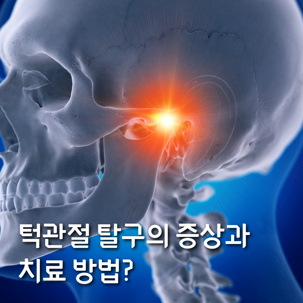 턱관절 탈구 증상과 치료 방법에 대해 알아보자 관련 이미지 1