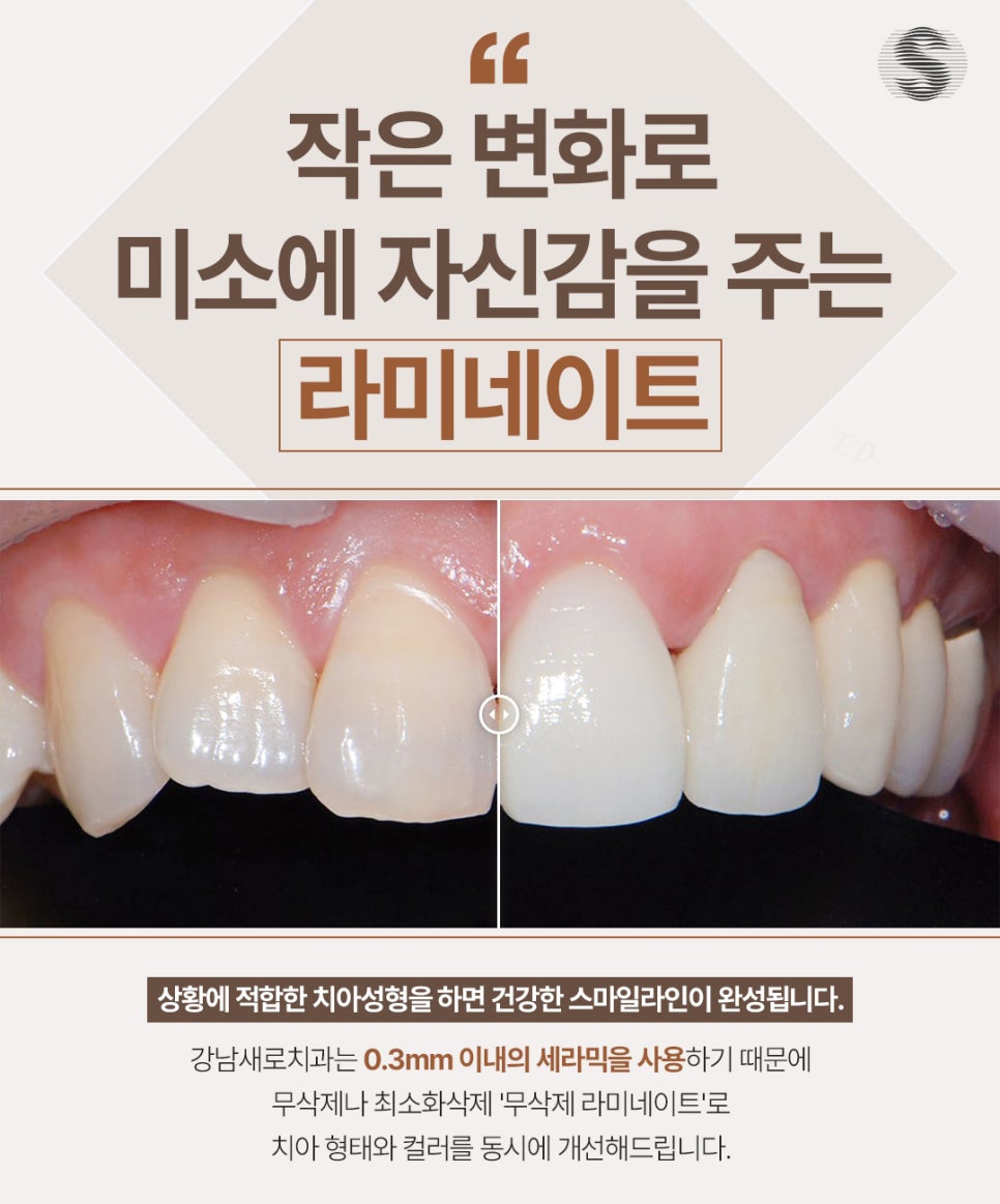 라미네이트 하기 전 고려해야 할 사항 관련 이미지 2