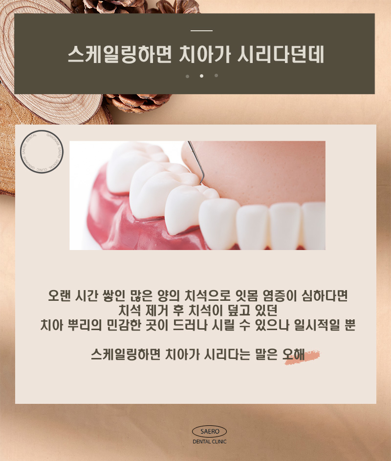 스케일링 오해와 진실 (치아 깎임, 흔들림, 벌어짐, 이시림, 무통스케일링) 관련 이미지 5