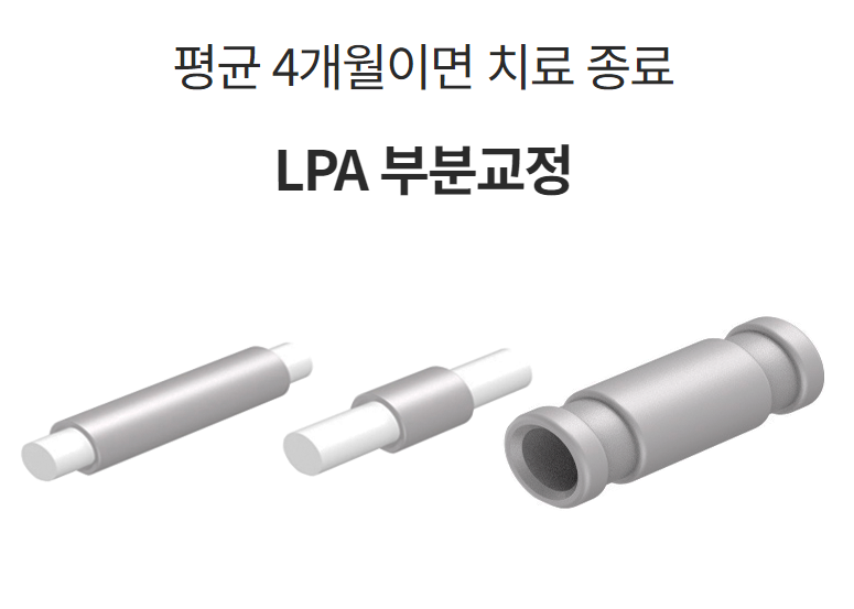 오스템 대표 최신식 자가결찰교정장치 (오스템교정) 관련 이미지 4