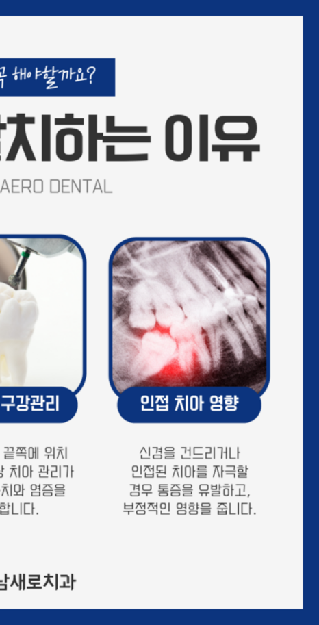 사랑니 잘 뽑는 곳, 발치를 진행하지 않아도 되는 경우? 관련 이미지 2