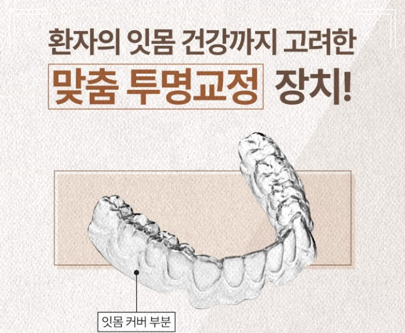 벌어진 앞니 교정, 단기간 치료로 해결? 관련 이미지 1