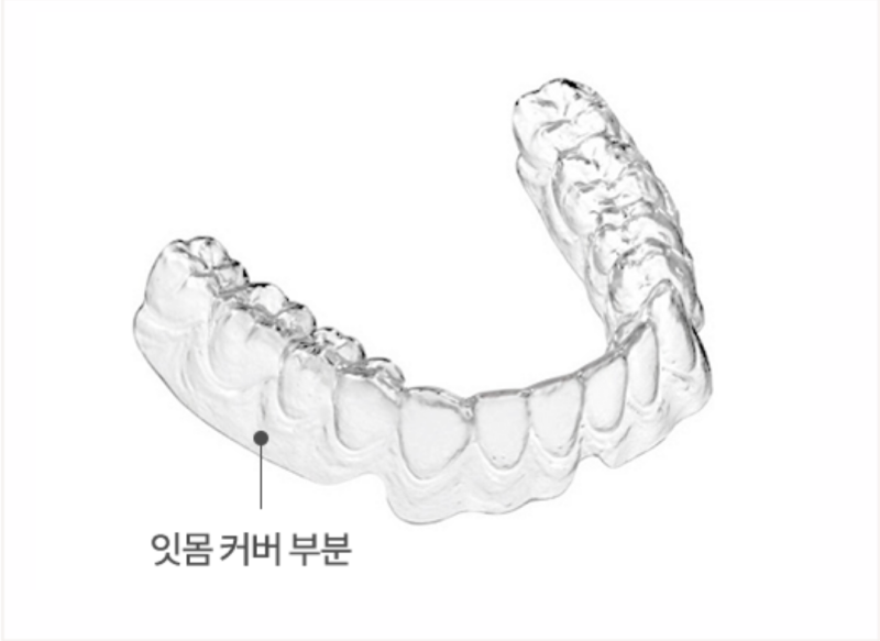 강남투명교정, 강남새로치과 나노라이너의 차별점 관련 이미지 6