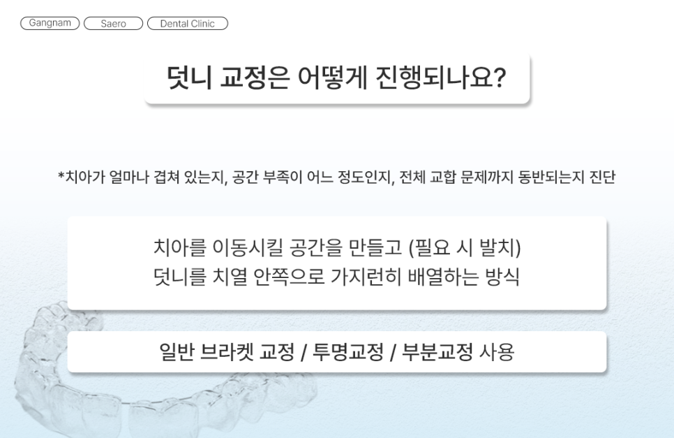 삐뚤어진 치아를 가지런하게 기능과 심미 회복 (덧니교정) 관련 이미지 5