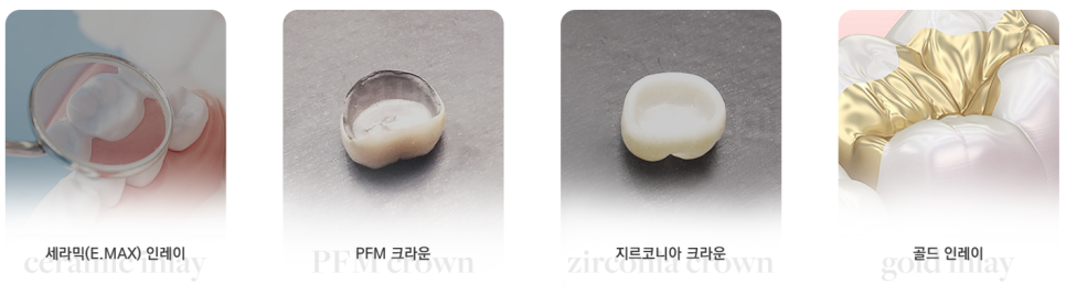 충치때우기 충치씌우기 차이, 크라운을 미루면 임플란트까지?! 관련 이미지 4