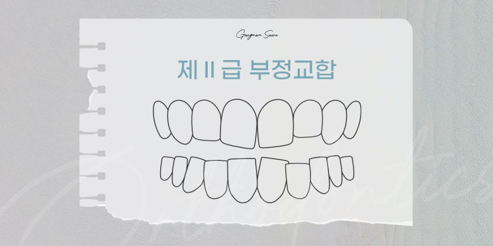 비수술 부정교합을 위한 치과 교정 (투명교정부정교합) 관련 이미지 5