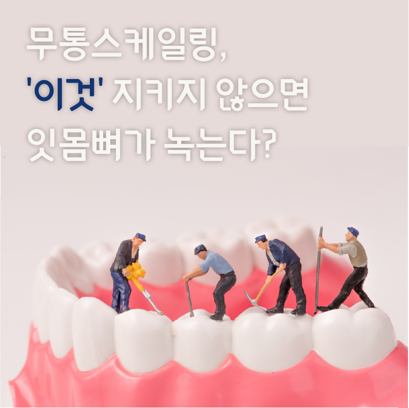 무통스케일링, 관련 이미지 1