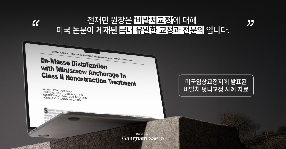 비발치 교정이 다 좋지만은 않은 이유 (발치교정 이유) 관련 이미지 7