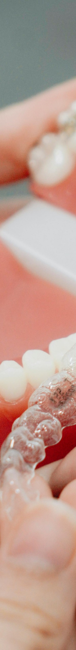 성인치아교정 치료, 부정교합, 구강 건강 개선이 될까요? 고민하고 계시다면 궁금증 타파해드립니다! 관련 이미지 9