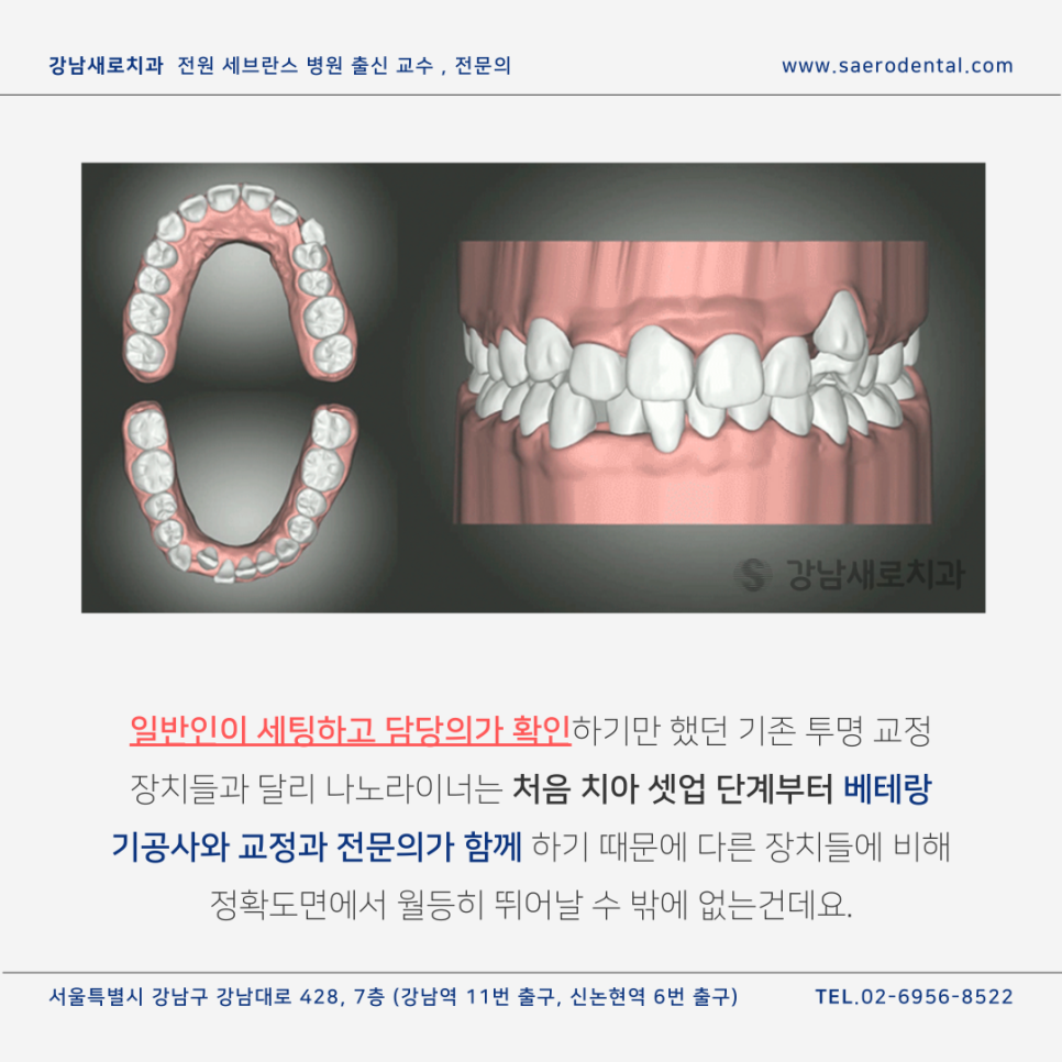 강남새로치과의 투명교정장치종류, 인비절라인과 나노라이너 관련 이미지 7