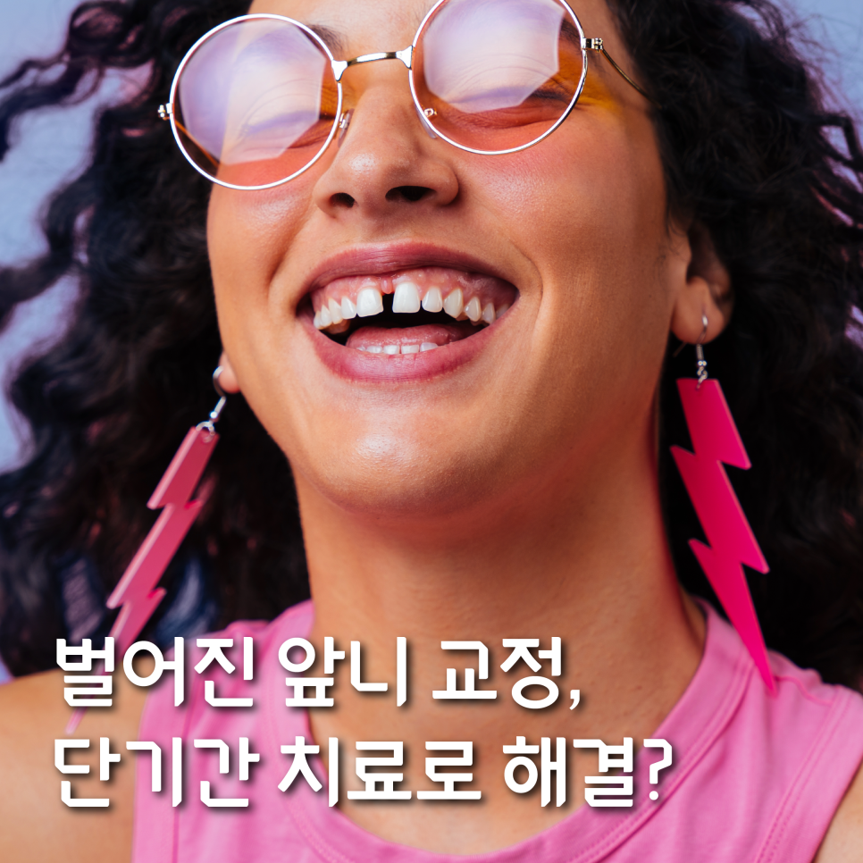 벌어진 앞니 교정, 단기간 치료로 해결? 관련 이미지 3