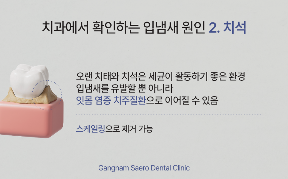 입냄새 치과에서 확인해야 할 몇 가지 (입냄새원인) 관련 이미지 4