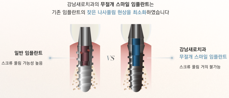 임플란트부작용 보철 (크라운, 지대주, 픽스쳐) 예방 및 대처 방법 관련 이미지 9