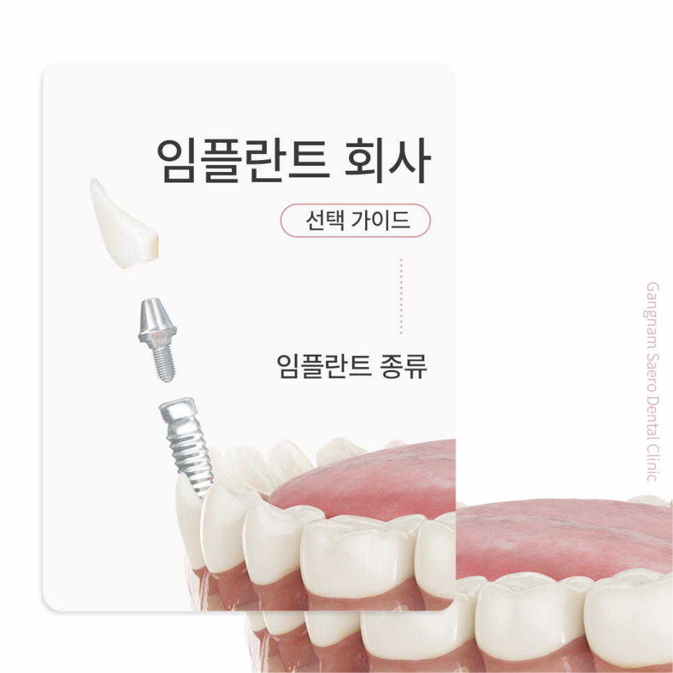 임플란트회사, 임플란트종류 선택 가이드 관련 이미지 1