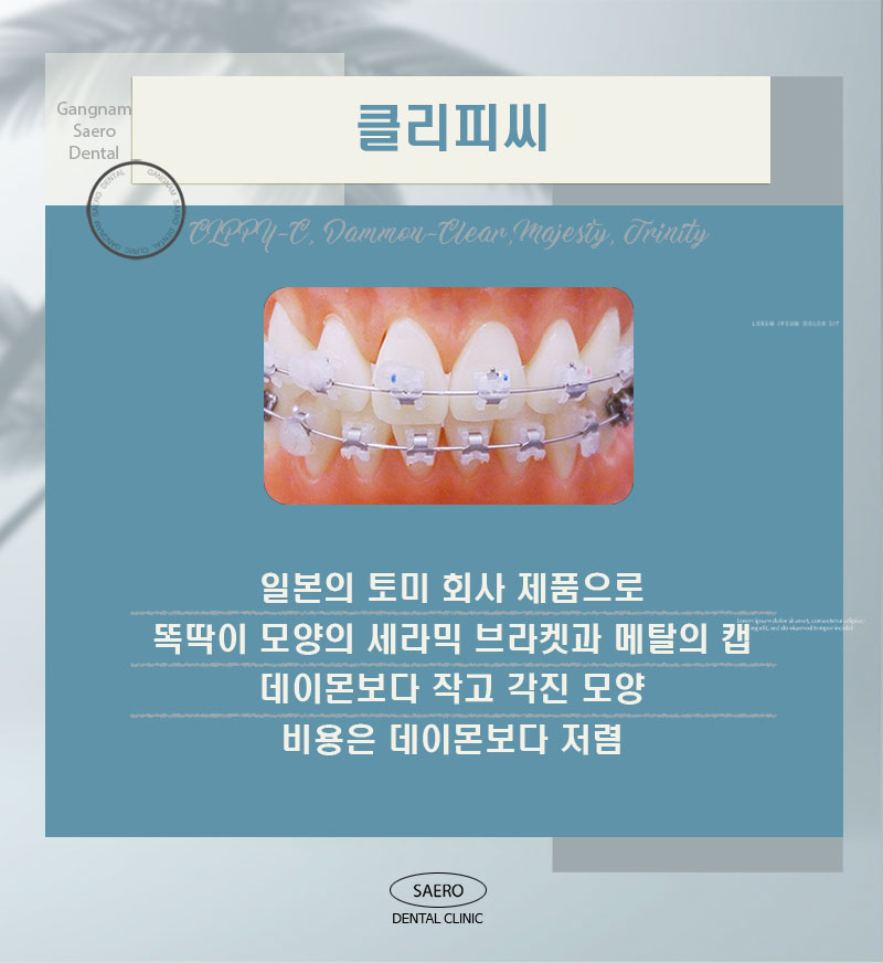 자가결찰교정과 클리피씨의 차이? (자가결찰교정 종류) 관련 이미지 3