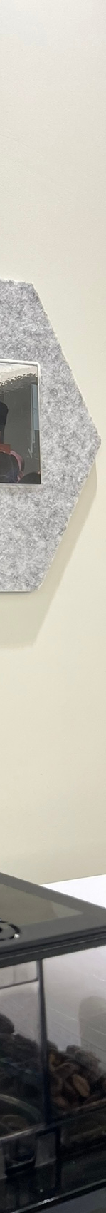 뻐드렁니교정치료, 돌출입을 단기간에 개선하는 방법? 관련 이미지 20