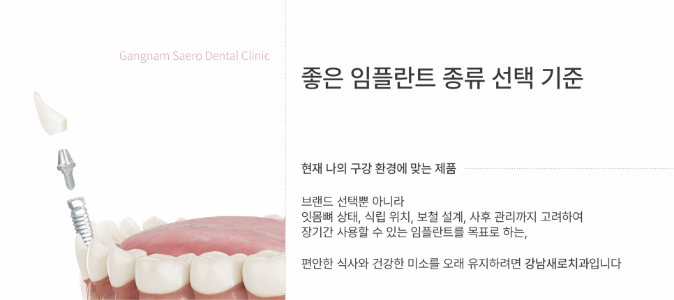 임플란트회사, 임플란트종류 선택 가이드 관련 이미지 7