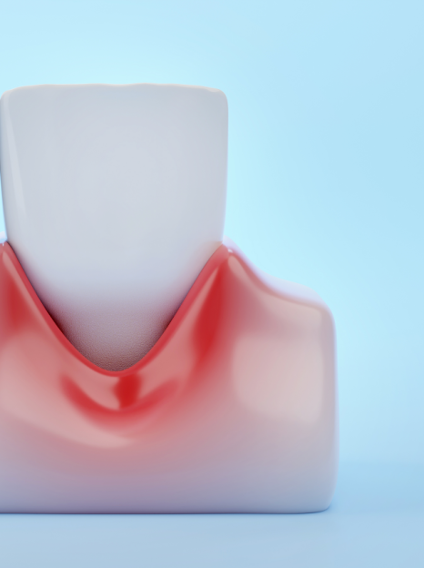 잇몸뼈 녹음이 발생하는 원인과 해결 방법 관련 이미지 5