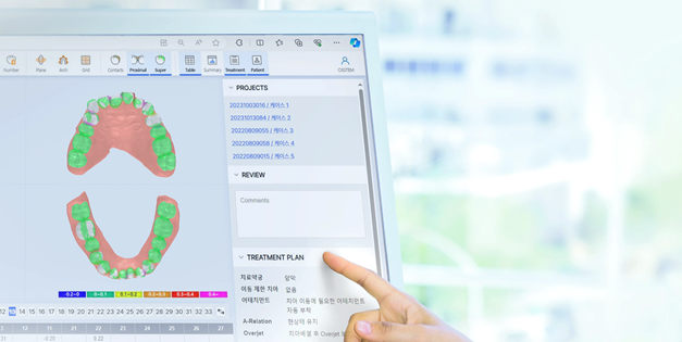 투명교정회사 투명교정종류 투명교정장치 (3) 매직얼라인 관련 이미지 4