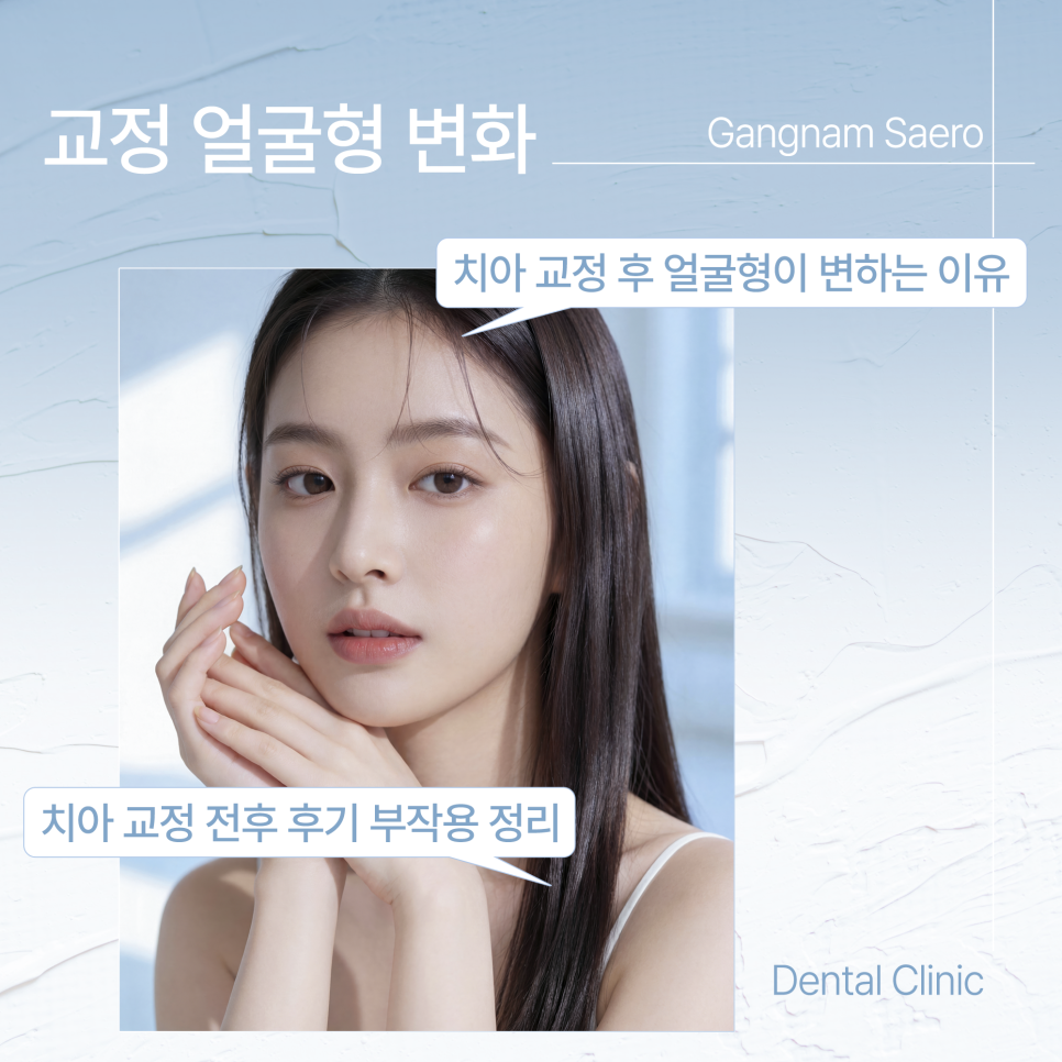 치아 교정 후 얼굴형이 변하는 이유 (교정얼굴형변화) 관련 이미지 1