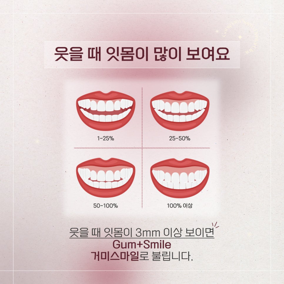 웃을때잇몸 많이 보인다면, 원인부터 알아보고 치료 결정하세요! 관련 이미지 2