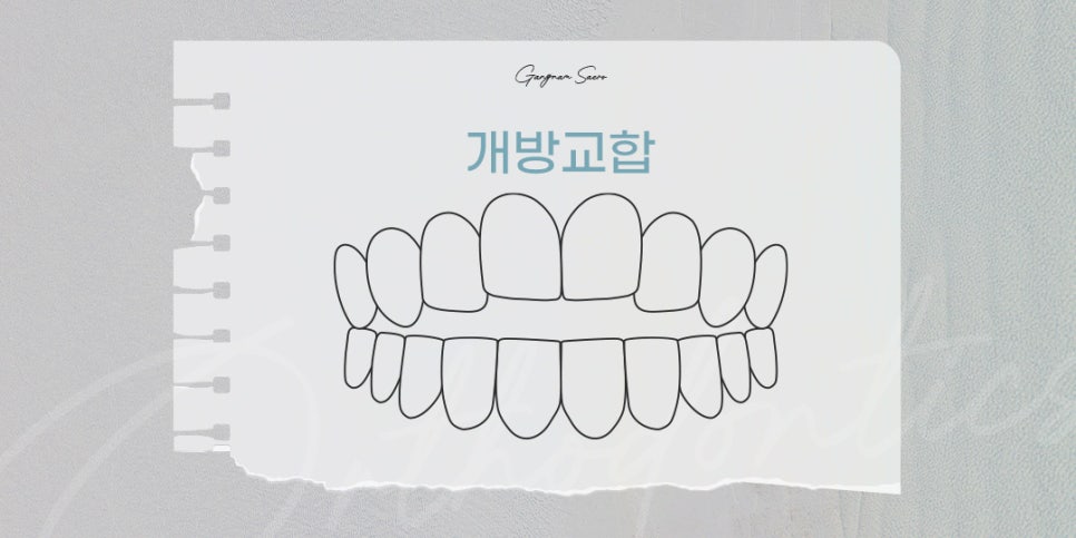 비수술 부정교합을 위한 치과 교정 (투명교정부정교합) 관련 이미지 7
